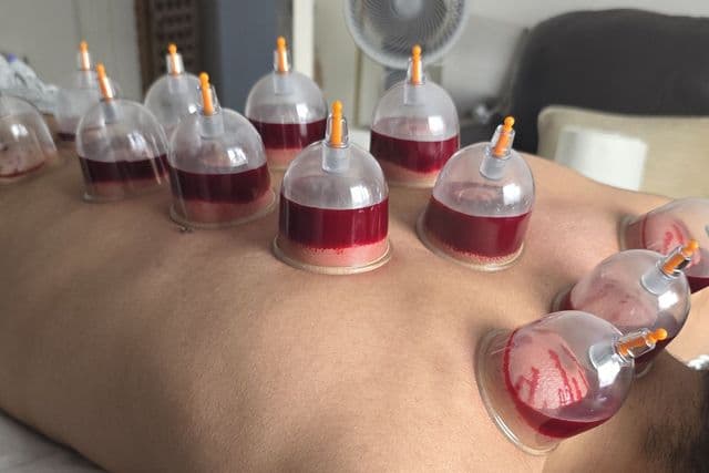 Herbal cupping and tension relief oils